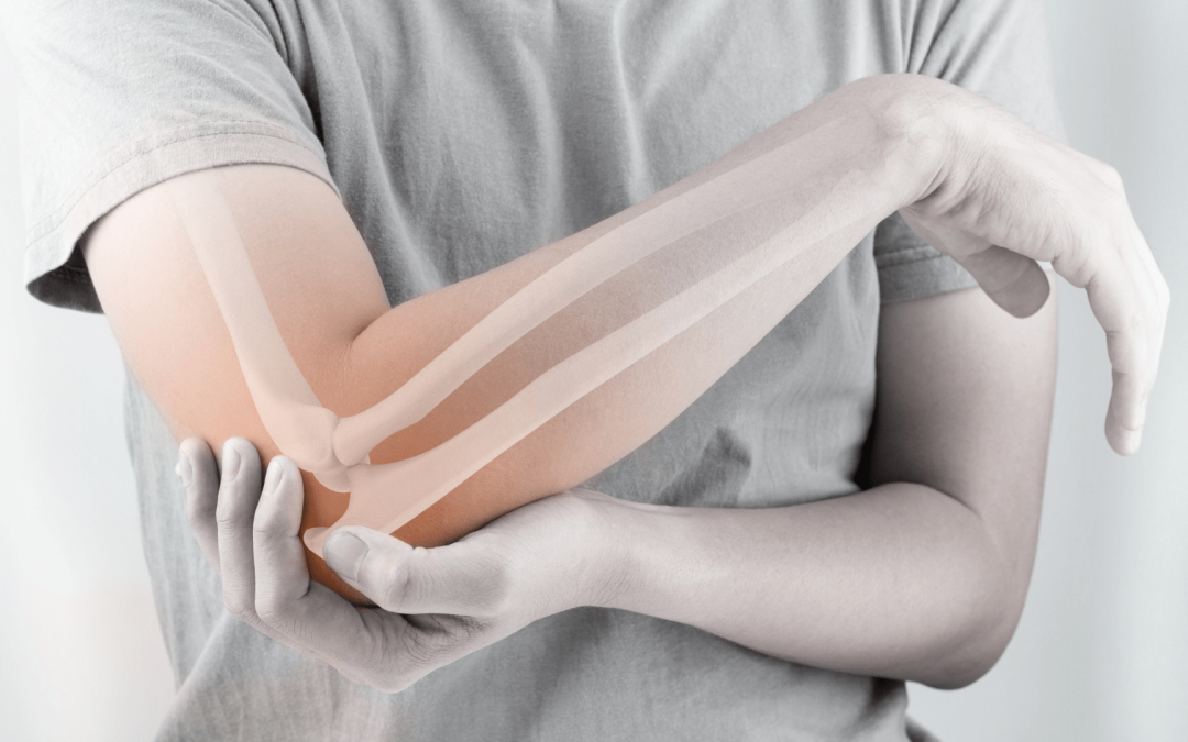 Nutrition et prévention de l’ostéoporose : comment des habitudes alimentaires adaptées peuvent renforcer vos os